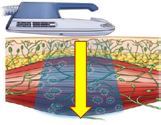 境町　ダイエット
