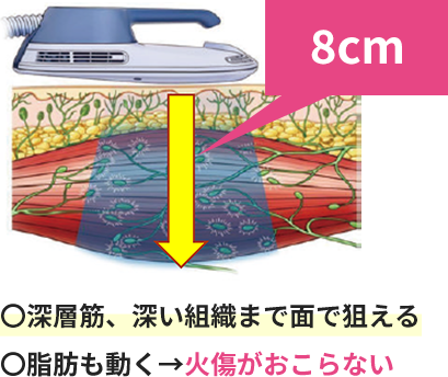 間々田　骨盤底筋